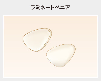 ラミネートべニア