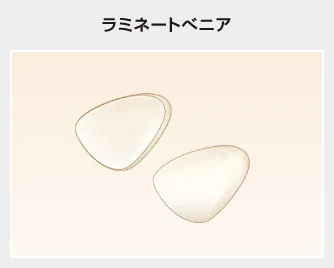 ラミネートべニア