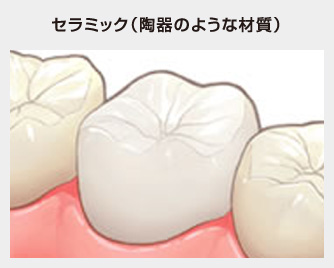 セラミック（陶器のような材質）