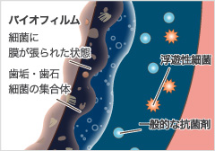 歯みがきだけではなかなか落ちないお口の汚れ