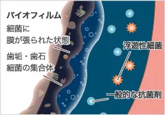 歯みがきだけではなかなか落ちないお口の汚れ