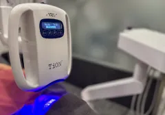 オフィスホワイトニング